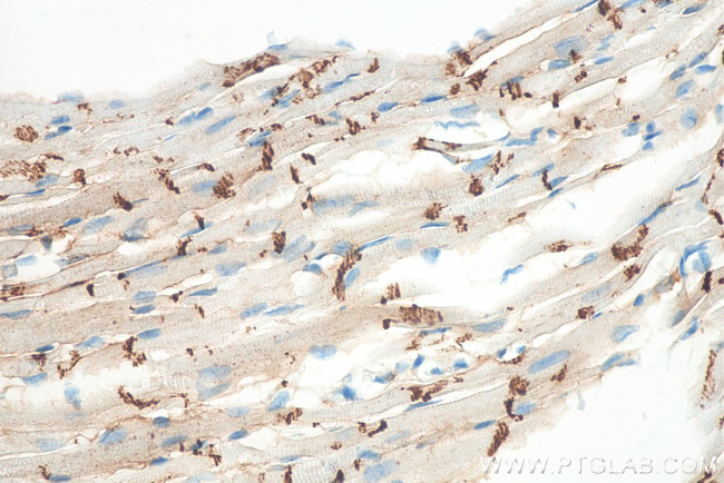 N-cadherin Antibody in Immunohistochemistry (Paraffin) (IHC (P))