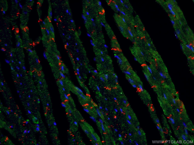 N-cadherin Antibody in Immunohistochemistry (PFA fixed) (IHC (PFA))