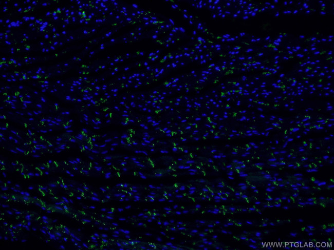 N-cadherin Antibody in Immunohistochemistry (PFA fixed) (IHC (PFA))