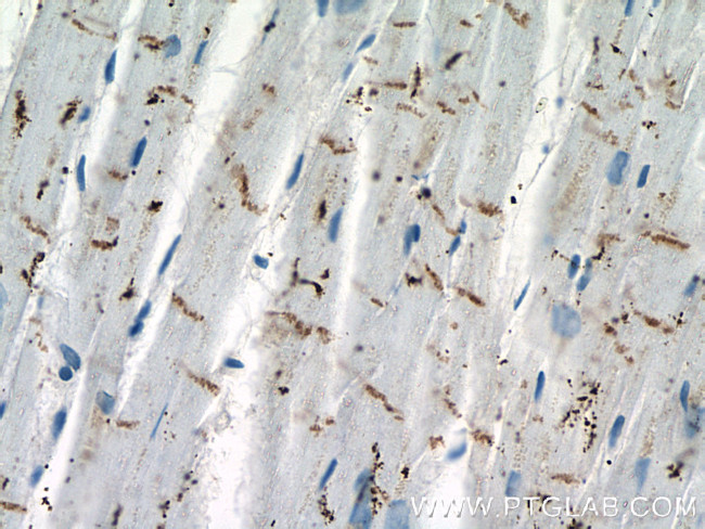 N-cadherin Antibody in Immunohistochemistry (Paraffin) (IHC (P))