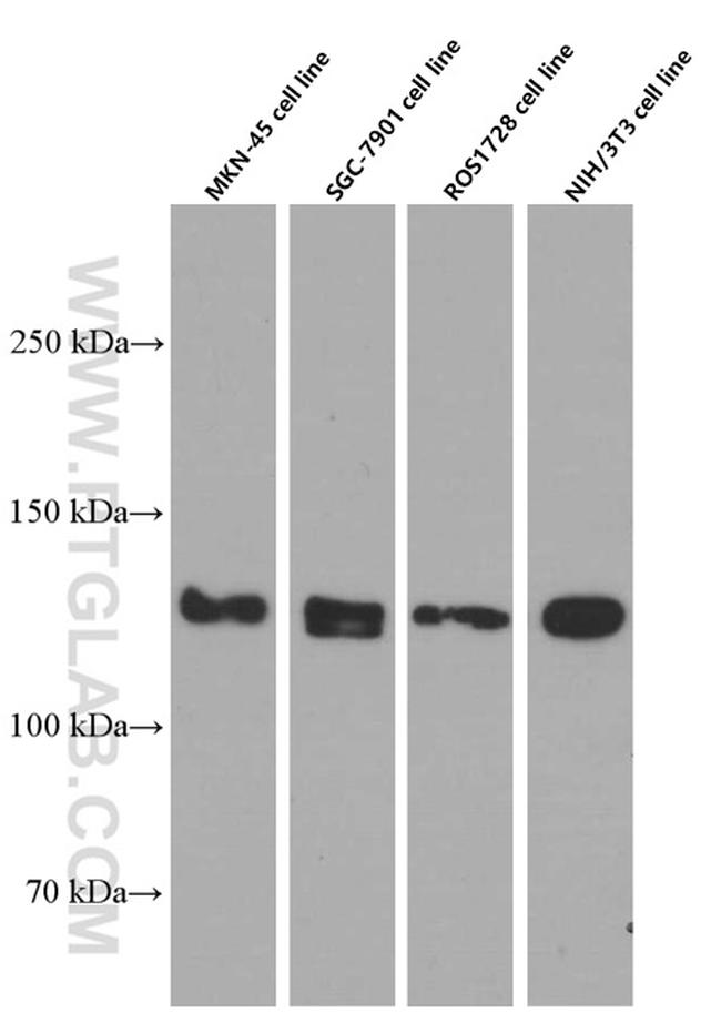 N-cadherin Antibody in Western Blot (WB)