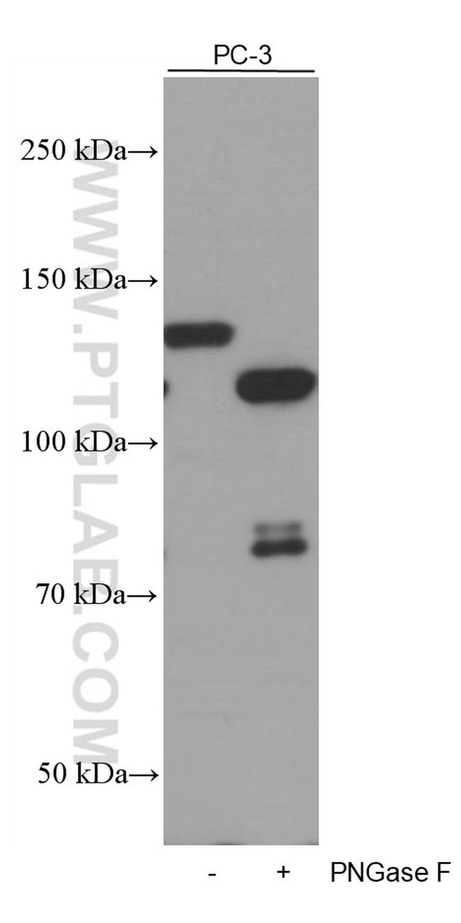 N-cadherin Antibody in Western Blot (WB)