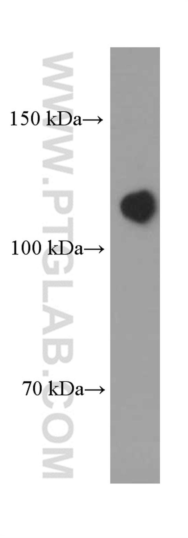 N-cadherin Antibody in Western Blot (WB)