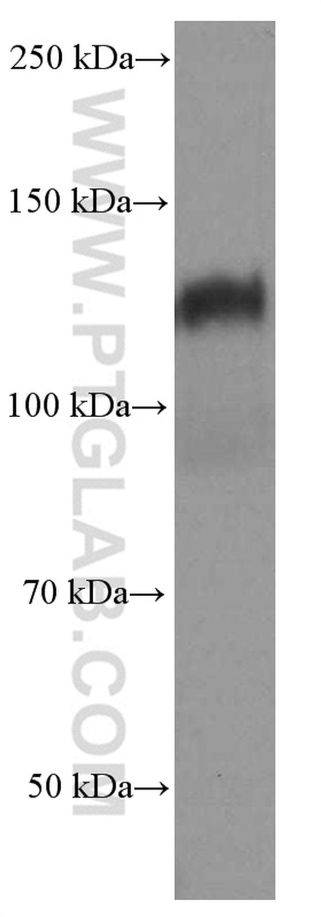 N-cadherin Antibody in Western Blot (WB)