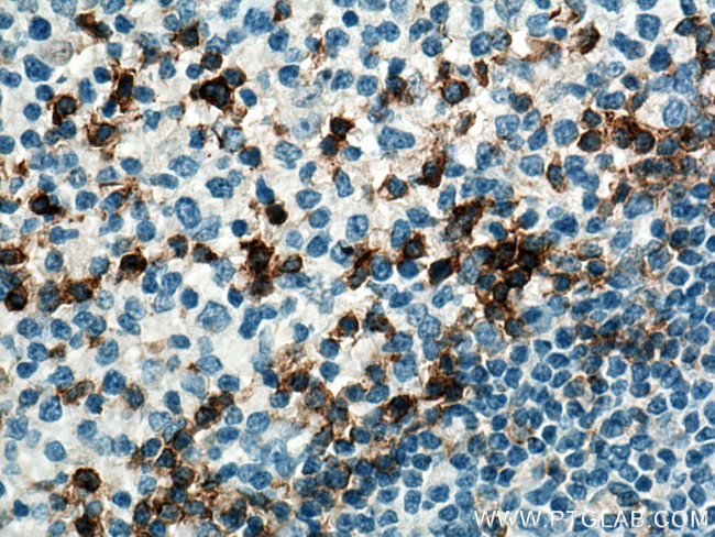 PD-1/CD279 Antibody in Immunohistochemistry (Paraffin) (IHC (P))