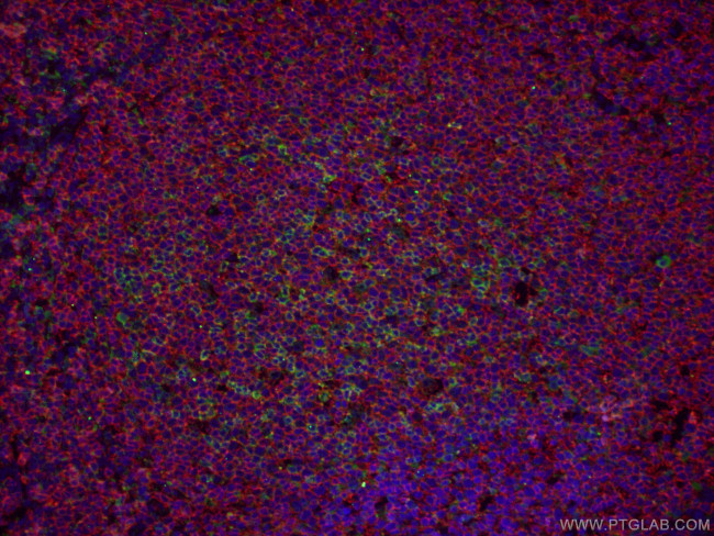 PD-1/CD279 Antibody in Immunohistochemistry (PFA fixed) (IHC (PFA))