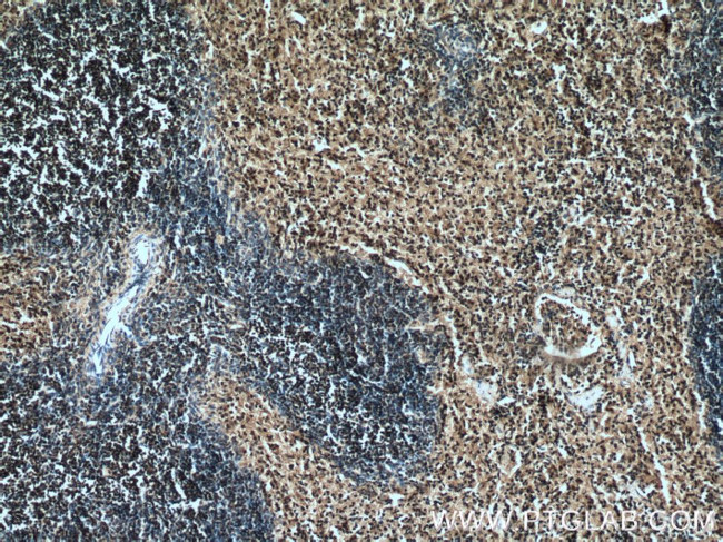 PD-1/CD279 Antibody in Immunohistochemistry (Paraffin) (IHC (P))