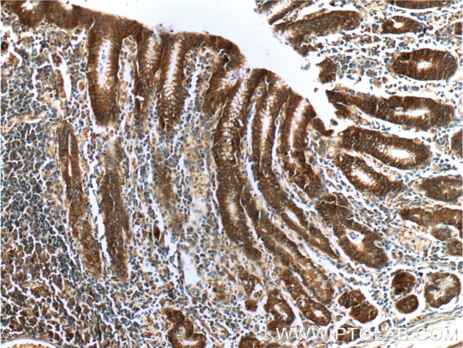 Alpha E catenin Antibody in Immunohistochemistry (Paraffin) (IHC (P))