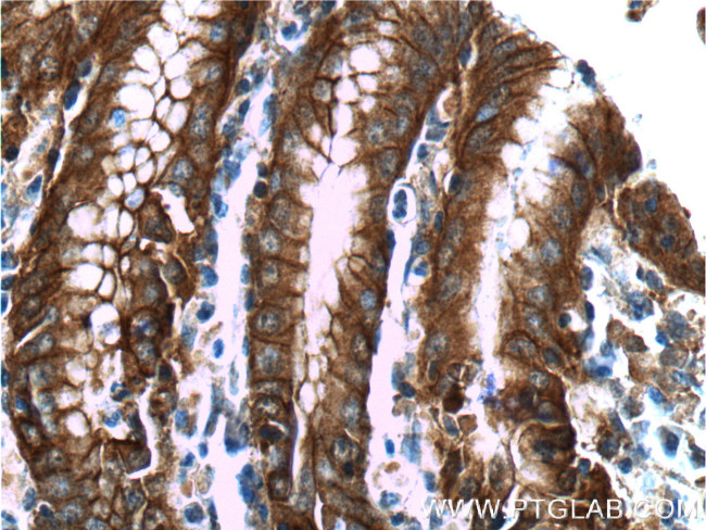 Alpha E catenin Antibody in Immunohistochemistry (Paraffin) (IHC (P))