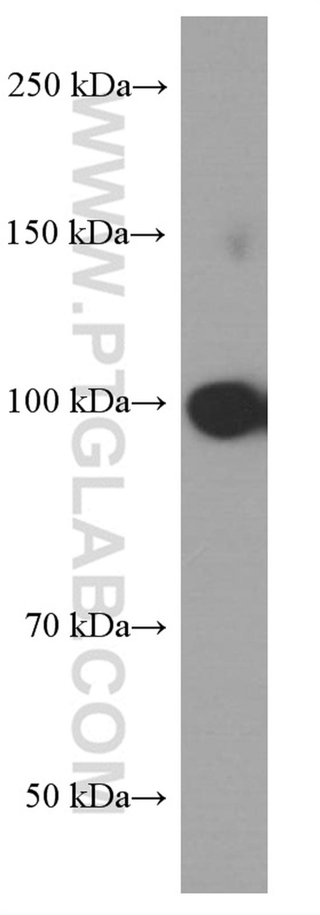 Alpha E catenin Antibody in Western Blot (WB)