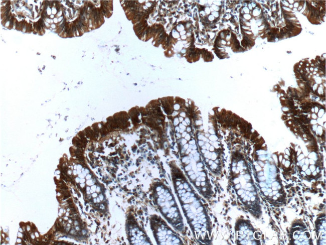 Alpha E catenin Antibody in Immunohistochemistry (Paraffin) (IHC (P))