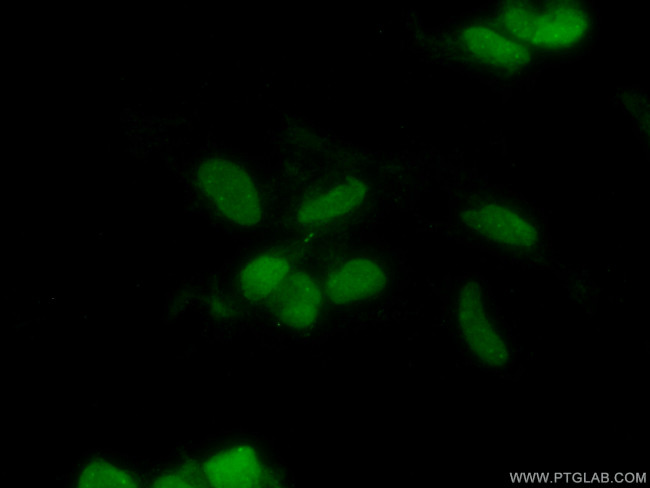 CHD4 Antibody in Immunocytochemistry (ICC/IF)