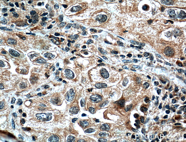 ORAI1 Antibody in Immunohistochemistry (Paraffin) (IHC (P))