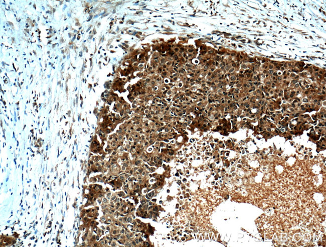 ORAI1 Antibody in Immunohistochemistry (Paraffin) (IHC (P))