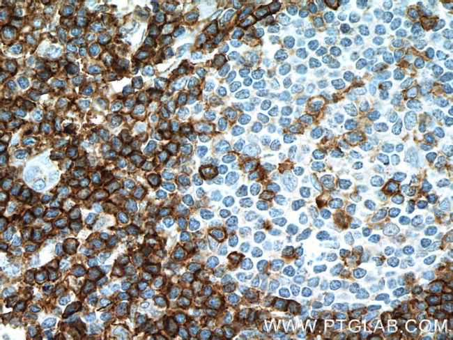 CD43 Antibody in Immunohistochemistry (Paraffin) (IHC (P))