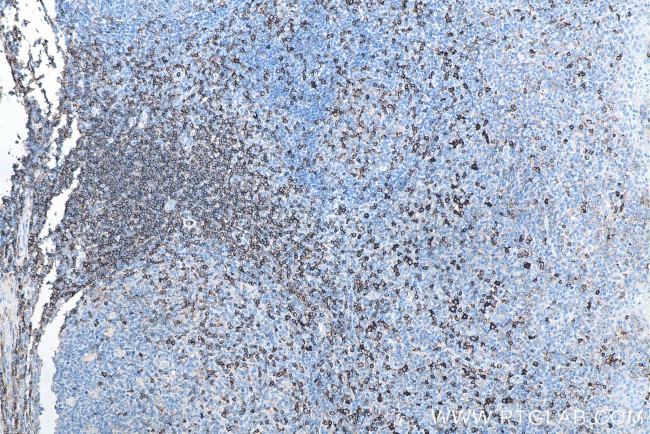 CD43 Antibody in Immunohistochemistry (Paraffin) (IHC (P))