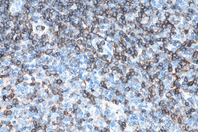 CD43 Antibody in Immunohistochemistry (Paraffin) (IHC (P))