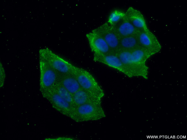 MALT1 Antibody in Immunocytochemistry (ICC/IF)