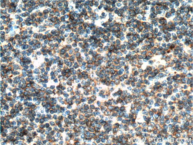 MALT1 Antibody in Immunohistochemistry (Paraffin) (IHC (P))