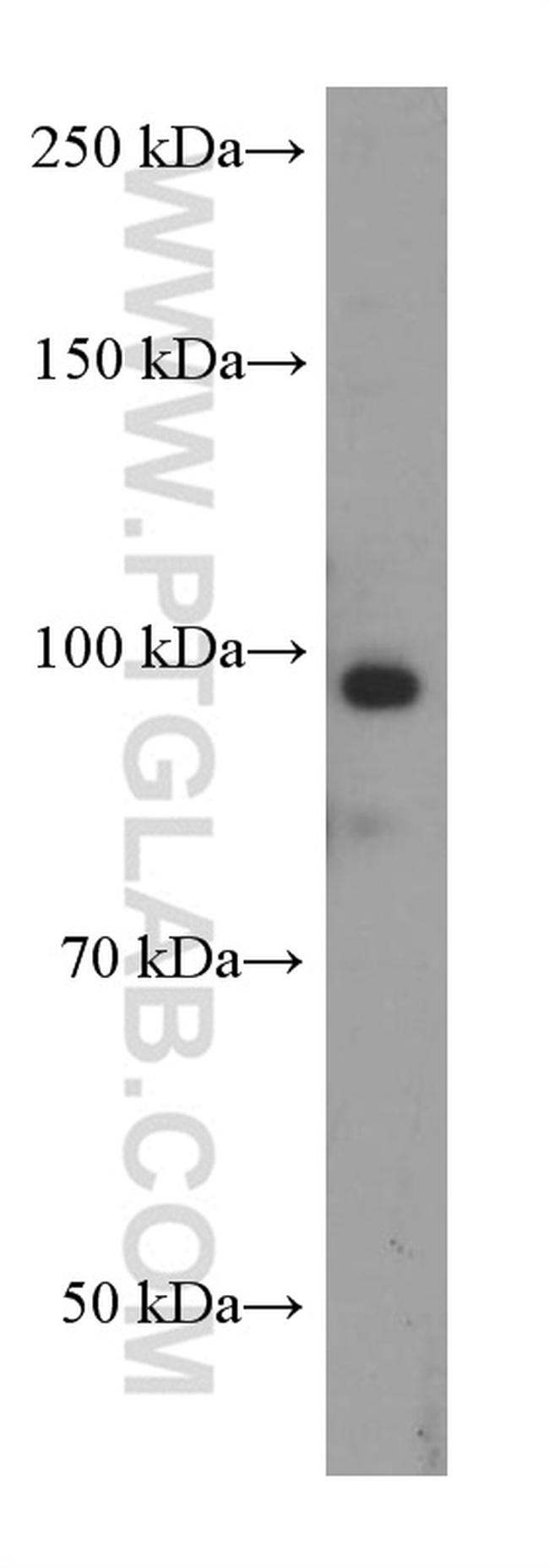 MALT1 Antibody in Western Blot (WB)