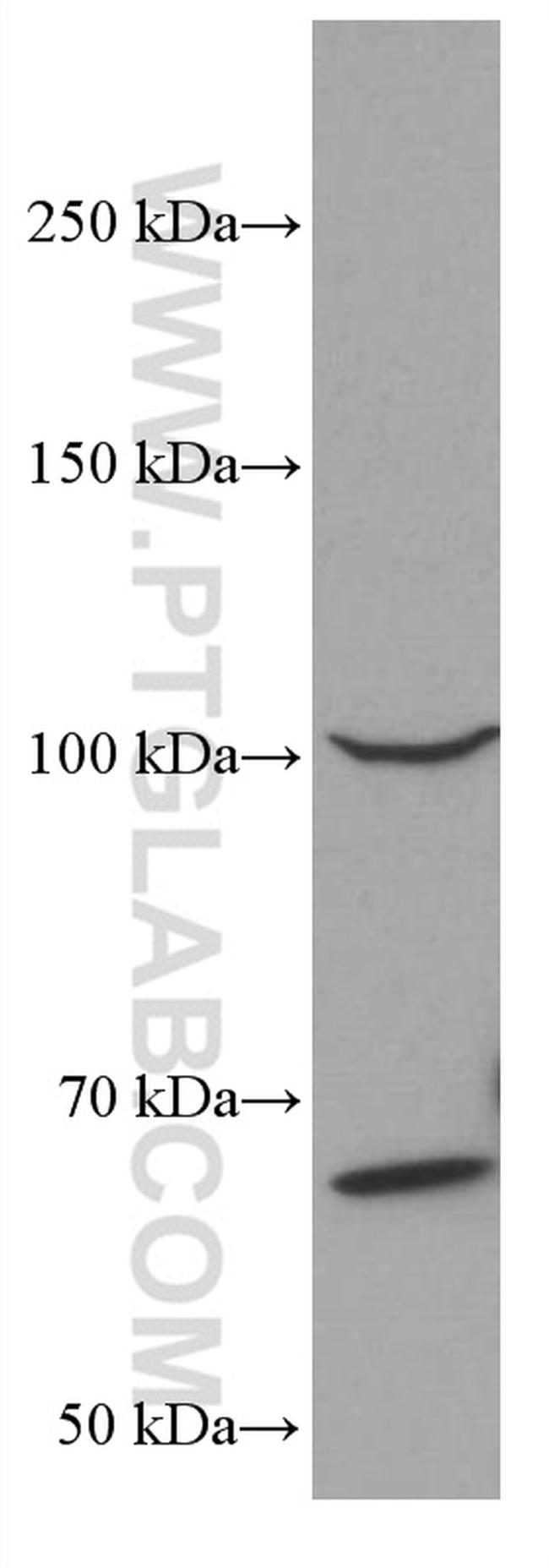 MALT1 Antibody in Western Blot (WB)