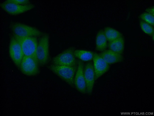 HPSE Antibody in Immunocytochemistry (ICC/IF)