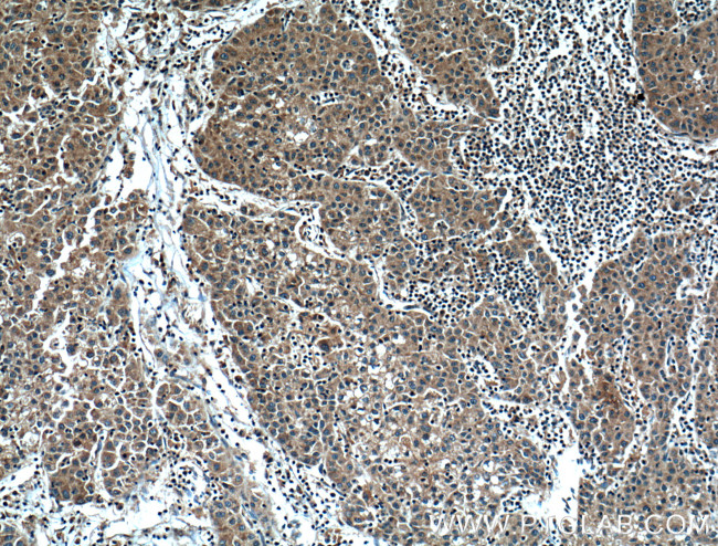 HPSE Antibody in Immunohistochemistry (Paraffin) (IHC (P))