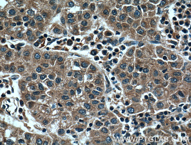 HPSE Antibody in Immunohistochemistry (Paraffin) (IHC (P))