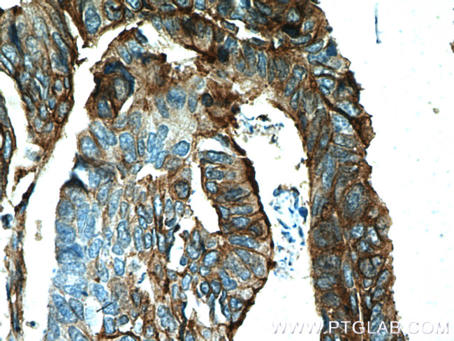 S100A10 Antibody in Immunohistochemistry (Paraffin) (IHC (P))