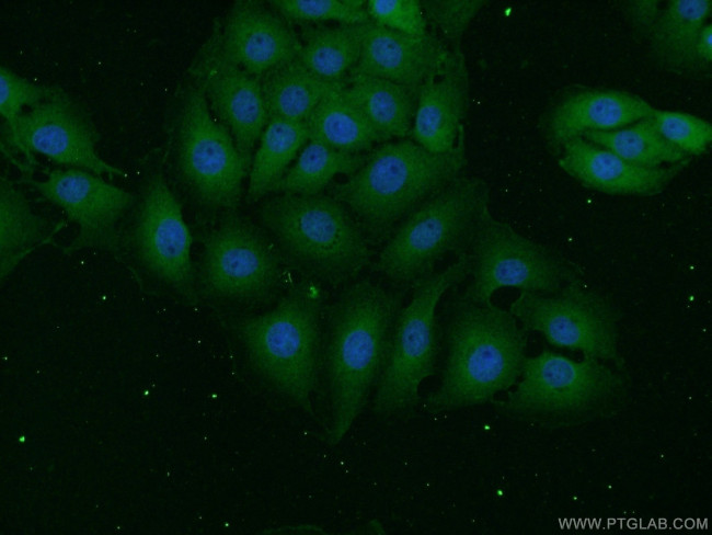 UCHL1 Antibody in Immunocytochemistry (ICC/IF)