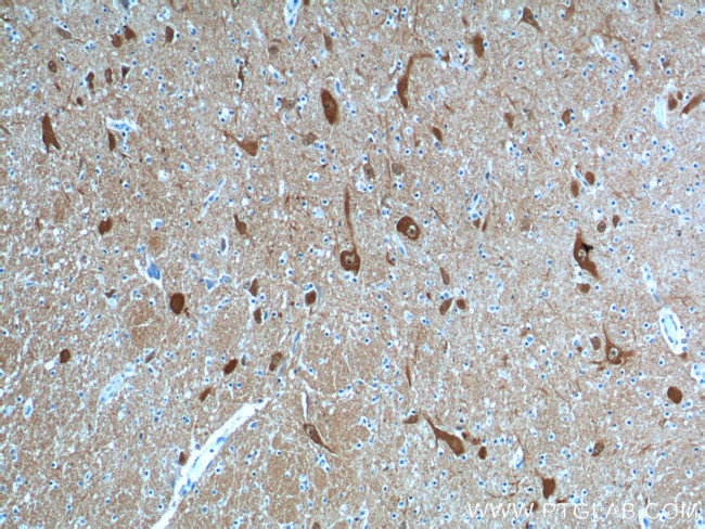 UCHL1 Antibody in Immunohistochemistry (Paraffin) (IHC (P))