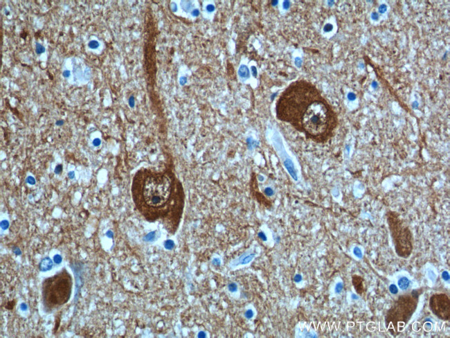 UCHL1 Antibody in Immunohistochemistry (Paraffin) (IHC (P))