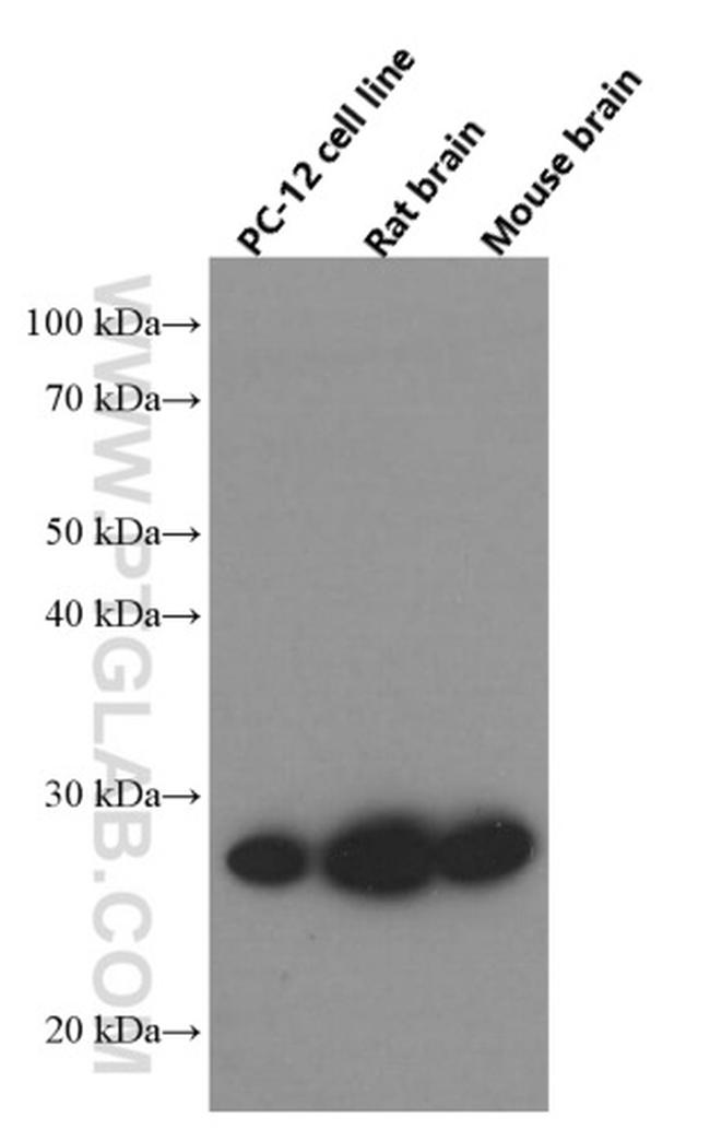 UCHL1 Antibody in Western Blot (WB)