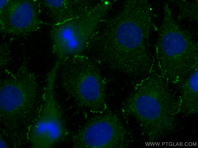 UCHL1 Antibody in Immunocytochemistry (ICC/IF)