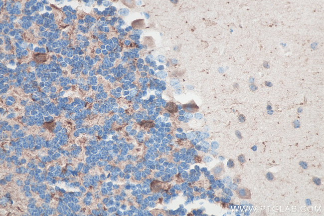 UCHL1 Antibody in Immunohistochemistry (Paraffin) (IHC (P))