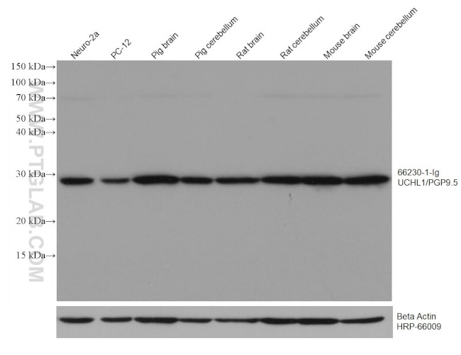 UCHL1 Antibody in Western Blot (WB)