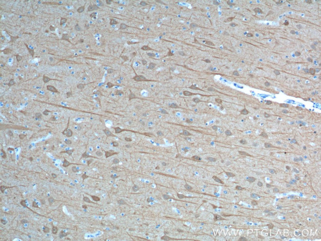 UCHL1 Antibody in Immunohistochemistry (Paraffin) (IHC (P))