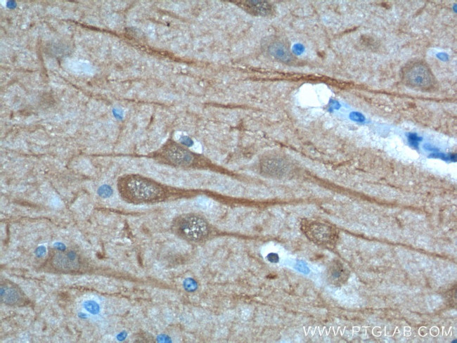 UCHL1 Antibody in Immunohistochemistry (Paraffin) (IHC (P))