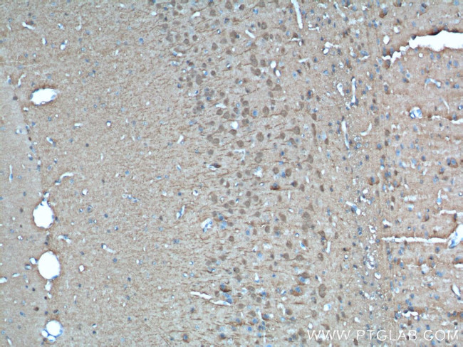 UCHL1 Antibody in Immunohistochemistry (Paraffin) (IHC (P))