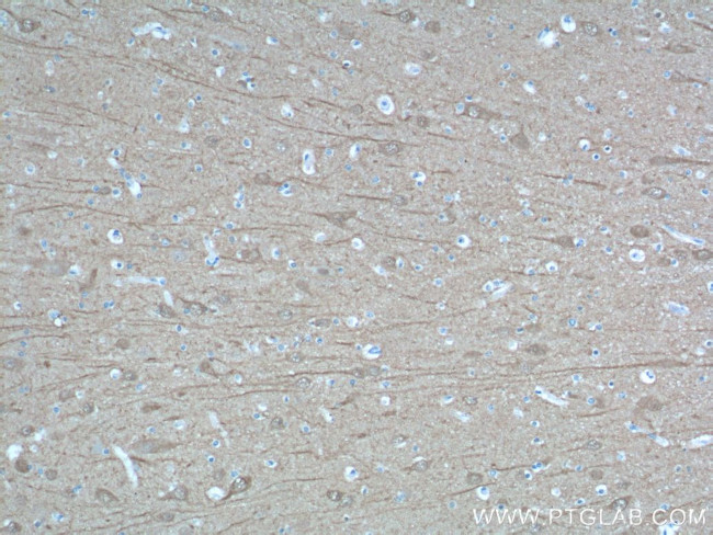 UCHL1 Antibody in Immunohistochemistry (Paraffin) (IHC (P))