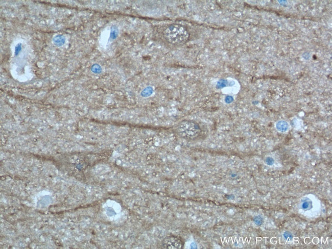 UCHL1 Antibody in Immunohistochemistry (Paraffin) (IHC (P))