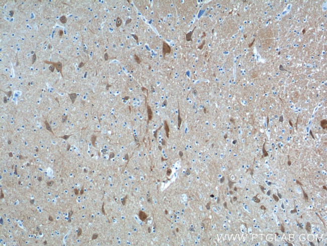 UCHL1 Antibody in Immunohistochemistry (Paraffin) (IHC (P))