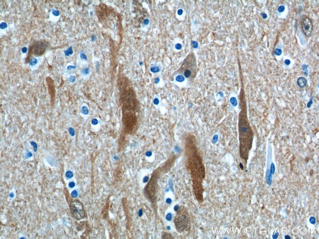 UCHL1 Antibody in Immunohistochemistry (Paraffin) (IHC (P))