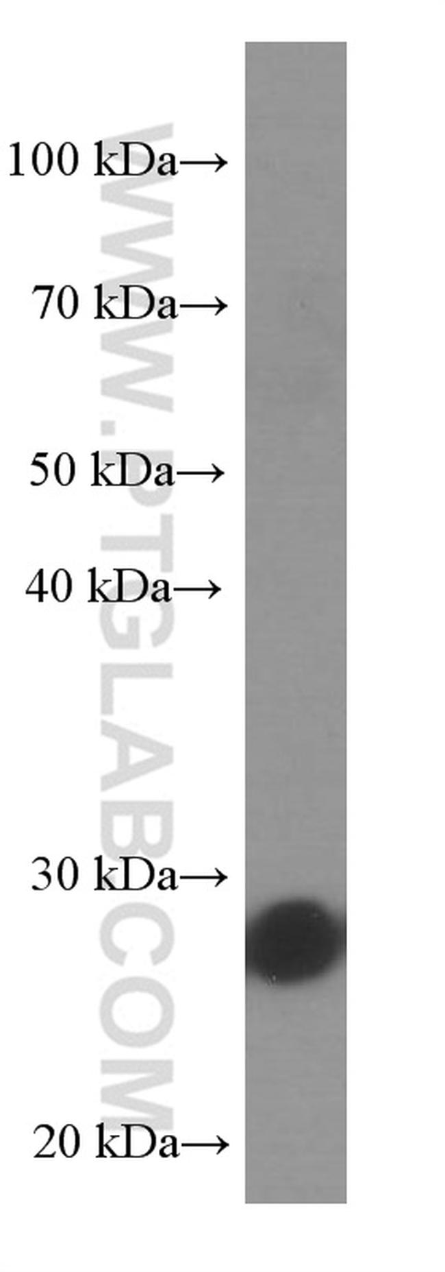 UCHL1 Antibody in Western Blot (WB)