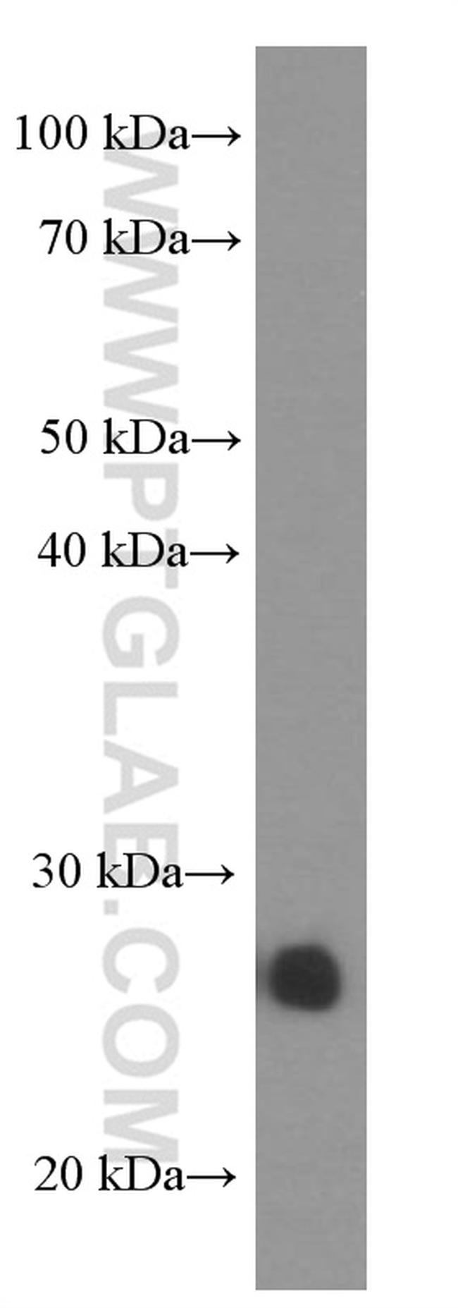 UCHL1 Antibody in Western Blot (WB)