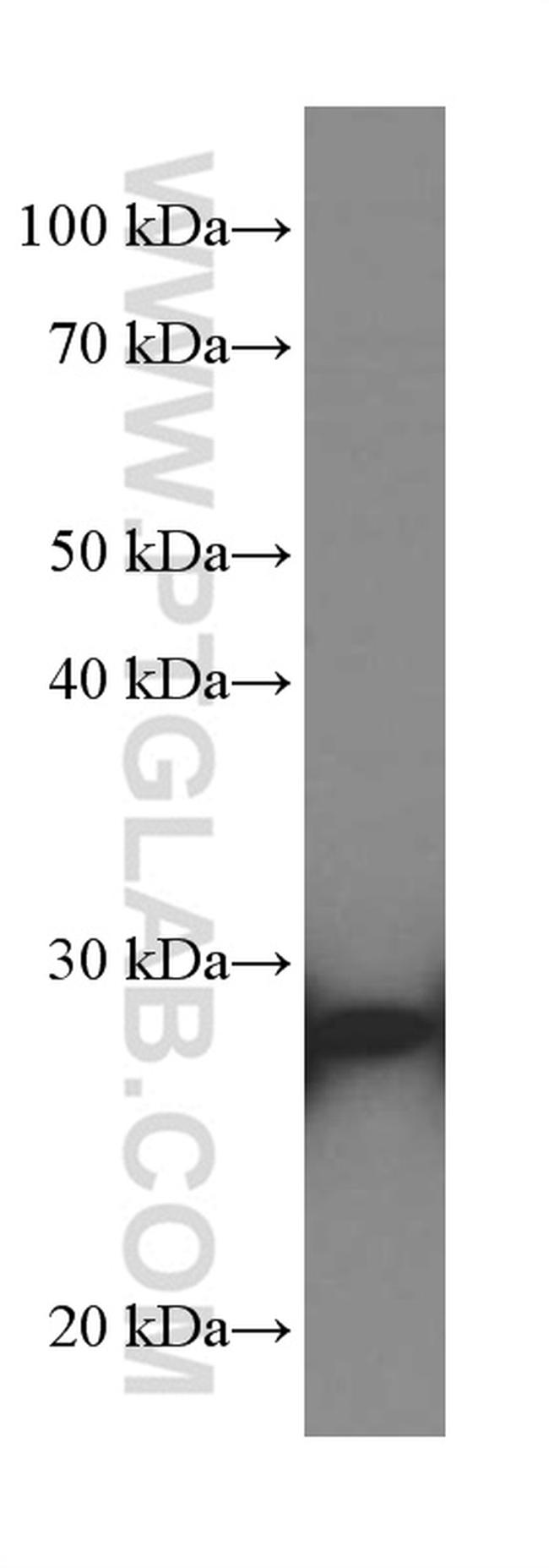 UCHL1 Antibody in Western Blot (WB)