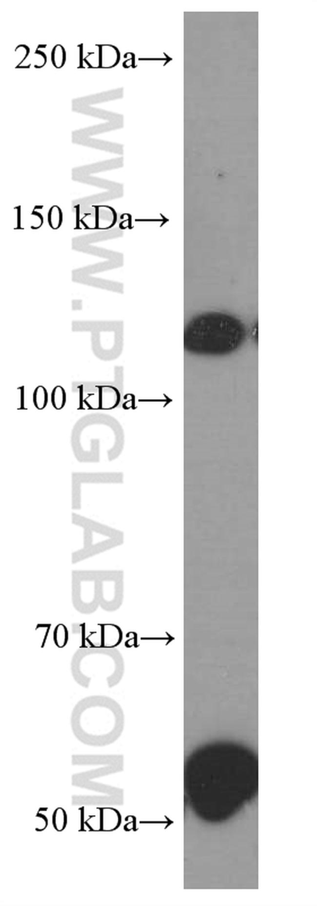 Pikachurin Antibody in Western Blot (WB)