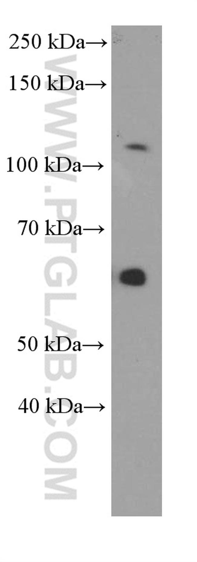 Pikachurin Antibody in Western Blot (WB)
