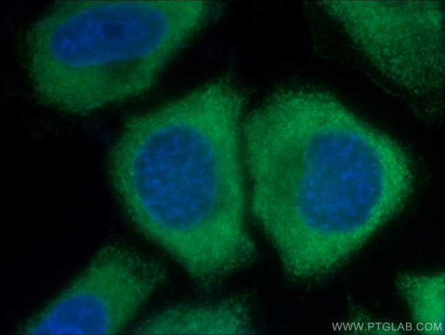 IL33 Antibody in Immunocytochemistry (ICC/IF)