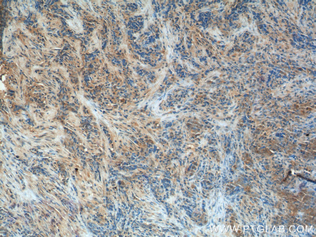 IL33 Antibody in Immunohistochemistry (Paraffin) (IHC (P))